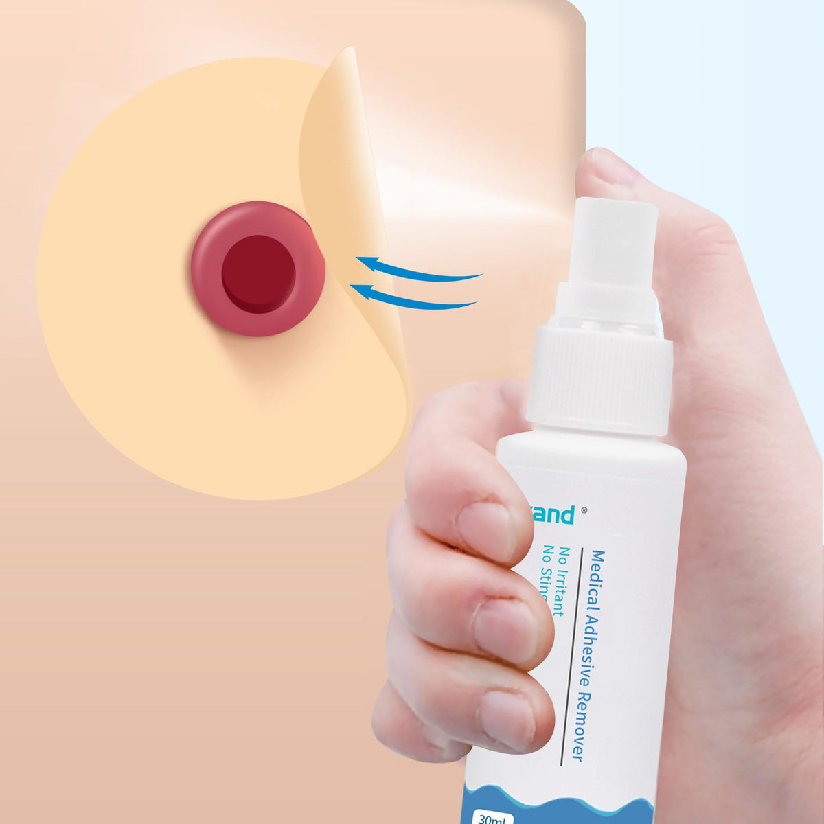 2oz Alcohol Free Sting Free Medical Adhesive Remover Spray E64416